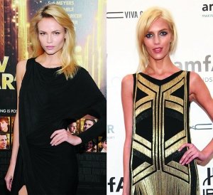 摩纳哥王子夜店被殴 面部受伤或需整形(图)