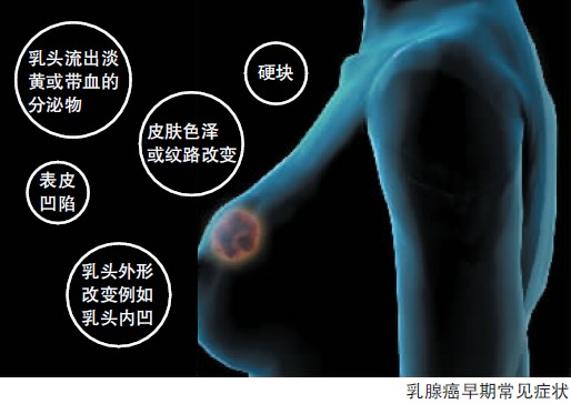 <em>女人三十</em>后每年<em>做</em>乳腺B超很重要-乳腺癌,有没