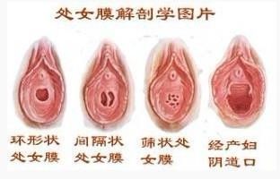 了解处女膜的生理作用（图）