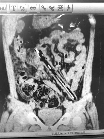 7���к���15���׳����������� 1���º��ȡ��