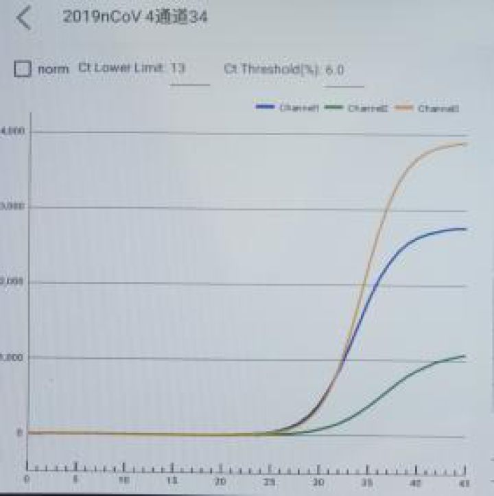 荧光定量pcr法检测乙肝病动_荧光定量pcr检测法(3)