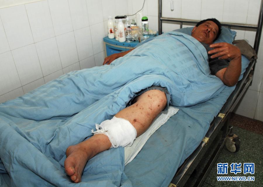 8月26日,左小腿轻伤的重庆籍乘客王咸泽在靖边县靖京中心医院接受