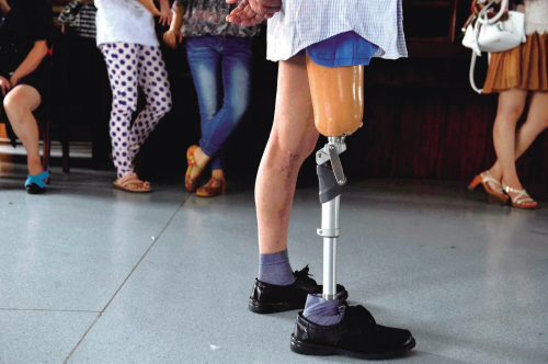 助行康复行动 政府埋单 安装假肢