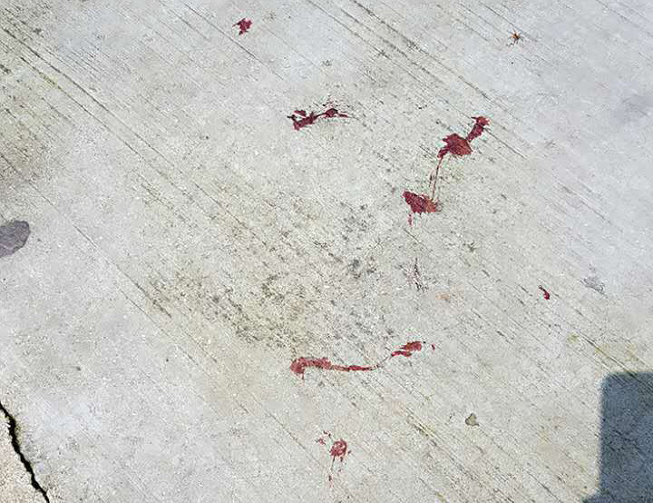血滴地板上的真实图片图片