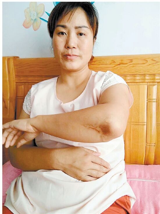 刘丽丽身上有一个特点,左胳膊肘上有一道明显的疤痕