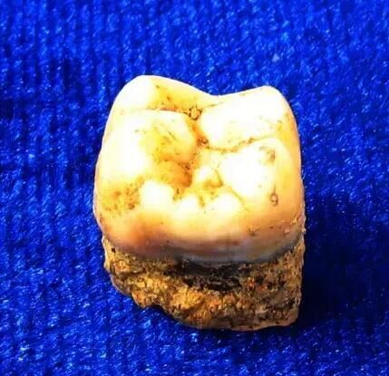 上山遗址出土的臼齿筛选中,发现了几颗"上山人"乳白色的牙齿.