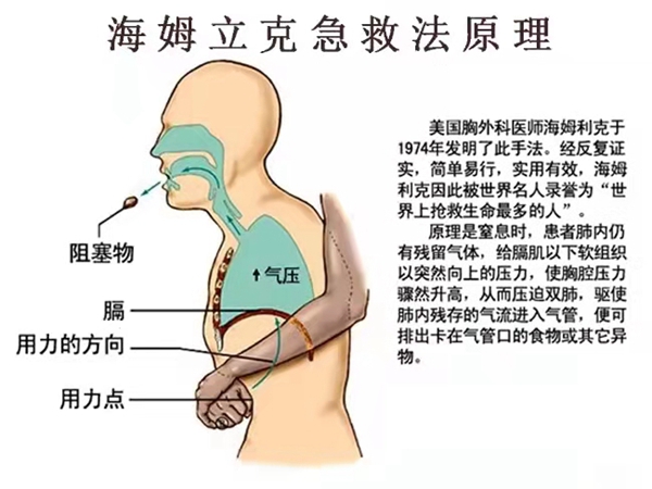 海姆立克急救位置图片